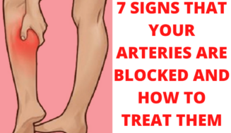 7 SIGNS THAT YOUR ARTERIES ARE BLOCKED AND HOW TO TREAT THEM